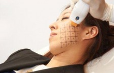 Thermage®答客問～～ 決定做之前先認識  Understanding Thermage®